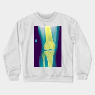 Knee x-ray (C022/3104) Crewneck Sweatshirt